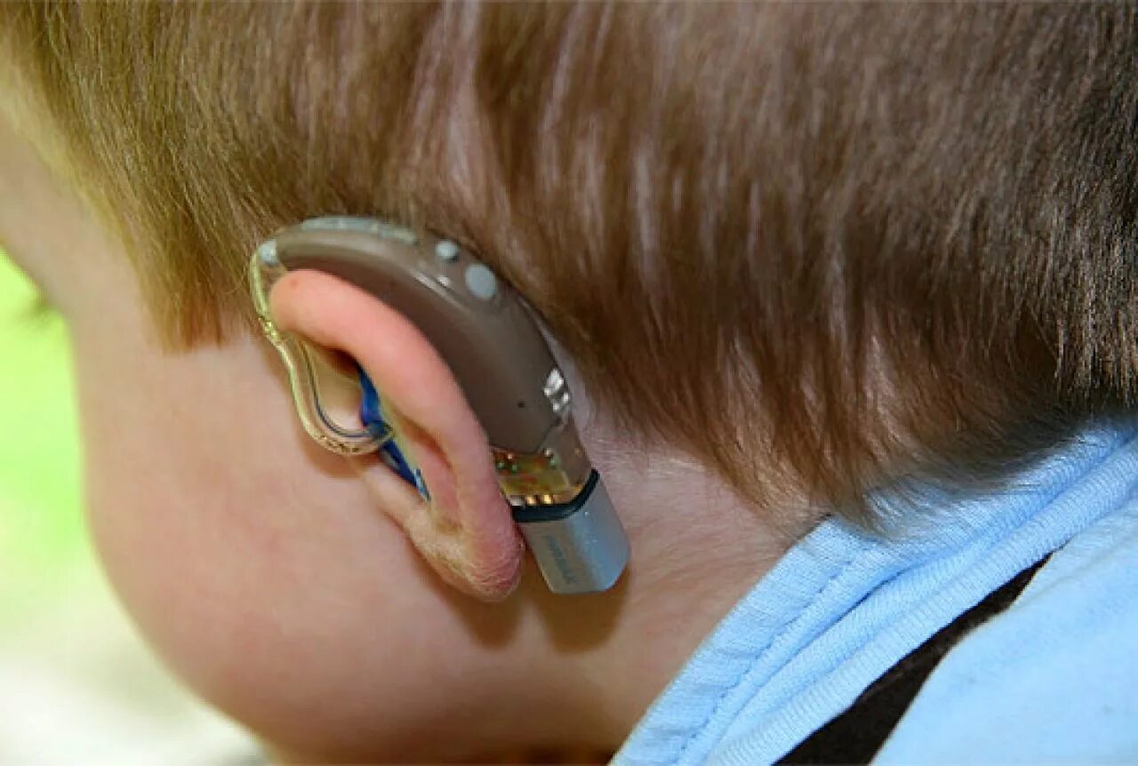 Слуховые стимулы. Кохлеарные Cochlear аппарат. Аппарат для глухих кохлеарная имплантация. Слуховой аппарат Cochlear 8. Слуховой аппарат электроника у2.