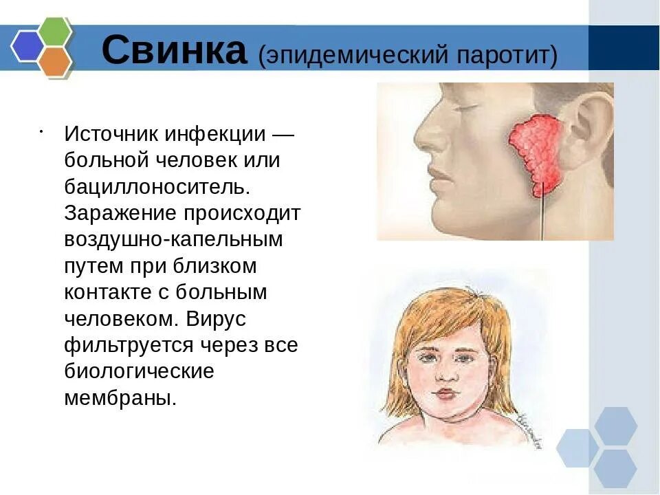 Симптом Филатова эпид паротит. Эпидемический паротит Свинка источник заражения. Инфекционный паротит симптомы. Свинка признаки болезни у детей симптомы