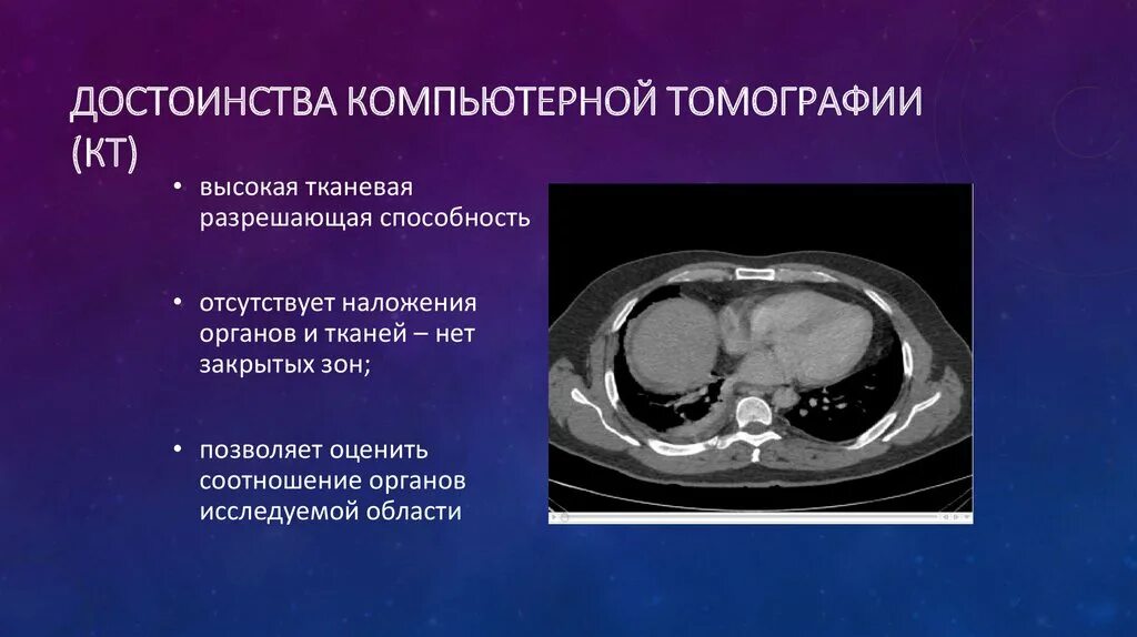 Можно по кт определить. Преимущества компьютерной томографии. Преимущества кт. Компьютерная томография презентация. Компьютерная томография ppt.