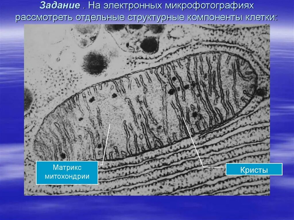 В световой микроскоп хорошо видны органоиды