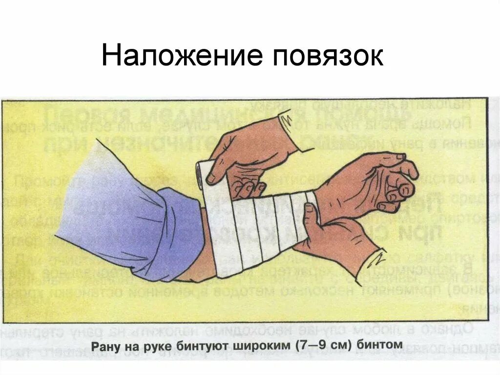 Наложение фиксирующей повязки. Первая помощь наложение повязок. Правило наложение повязок. Наложение повязок обж. Первая помощь наложение повязок.
