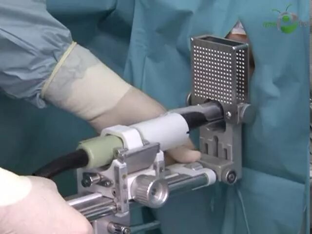 Сколько времени делается биопсия предстательной железы. Fusion биопсия предстательной железы. трансперинеальная fusion биопсия. сатурационная биопсия простаты. промежностная биопсия простаты.