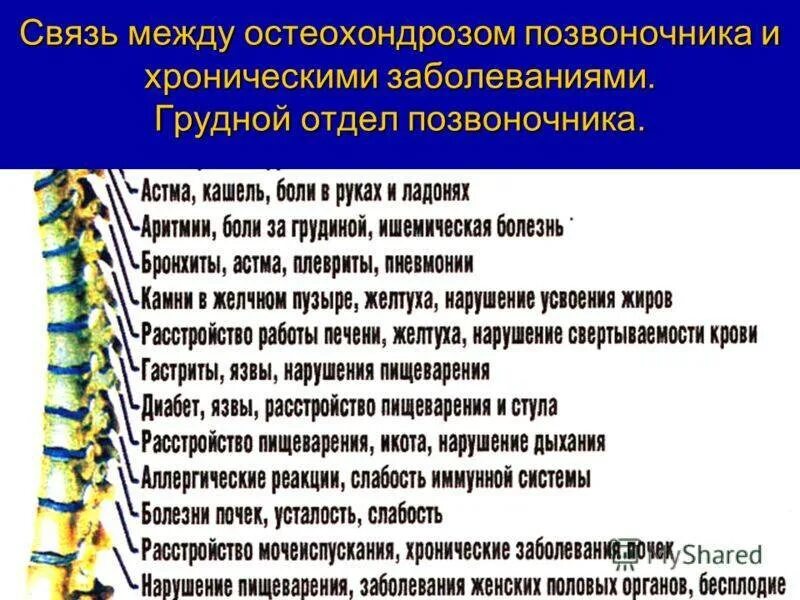 Снять спазм грудного отдела. Остеохондроз грудного отдела спереди. остеохондроз грудного отдела симптомы. остеохондроз грудного отдела позвоночника симптомы у мужчин. защемление нерва в грудном отделе позвоночника симптомы.