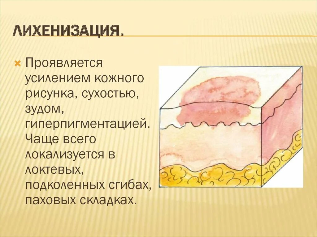 Вторичные элементы. Вторичные морфологические элементы кожи лихенификация. лихенификация морфологический элемент. лихенификация атопическийтдерматит. лихенификация дерматовенерология.