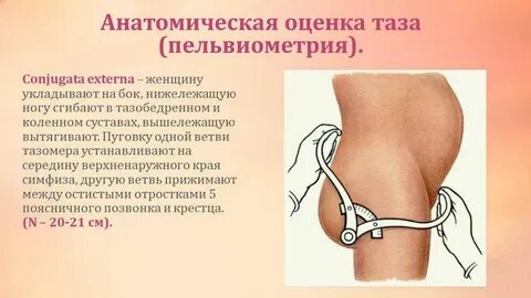Какие размеры узкого таза