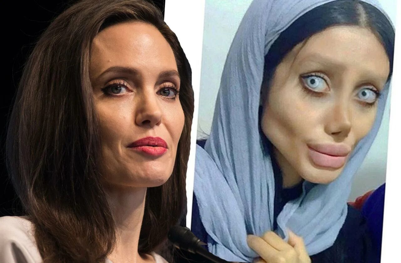 Сахар табар и Анджелина Джоли. Анджелина Джоли пластические операции. Вторая Анджелина Джоли 50 операций. Анджелина Джоли девушка похожая Пластикс.