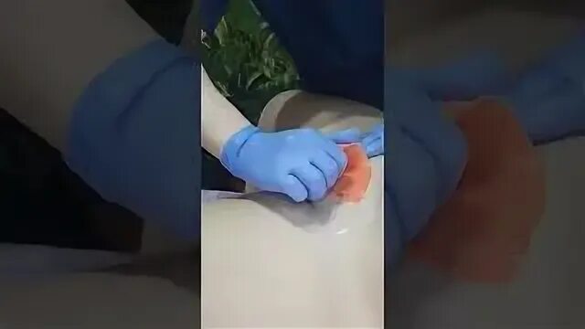 Лазерное бикини глубокое видео