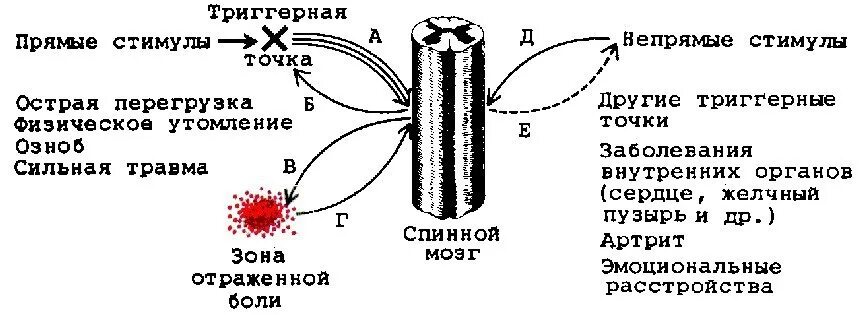 Точка это. Триггерные точки. Триггерные зоны. Триггерная точка в мышцах. Строение триггерной точки.