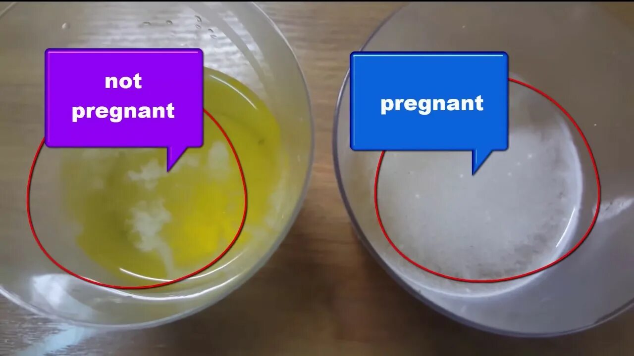 Тест на беременность на сахаре. Тест на беременность с содой. Реакция соды с мочой. Моча сода беременность. Реакция с содой на беременность.