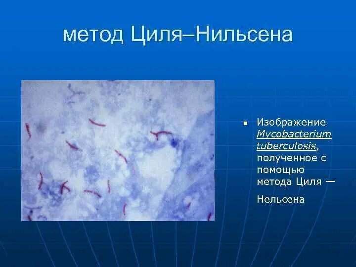 Туберкулез циль нильсену. Метод окраски по Цилю-Нильсену. Методы окраски бактерий по Цилю Нильсену. Окраска кислотоустойчивых бактерий по Цилю Нильсену. Циля Нильсена окраска метод.