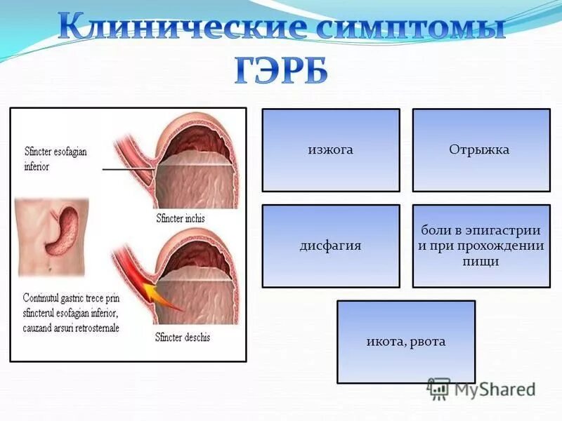 Икота с отрыжкой.