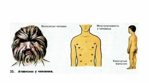 Густой волосяной покров на теле человека