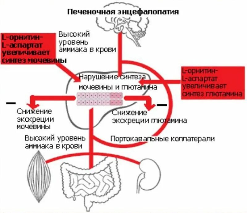 Острая печеночная недостаточность печеночная энцефалопатия. Схема патогенеза печеночной энцефалопатии. Острая печеночная энцефалопатия при вирусном гепатите. Печеночная энцефалопатия механизм развития. Стадии печеночной энцефалопатии