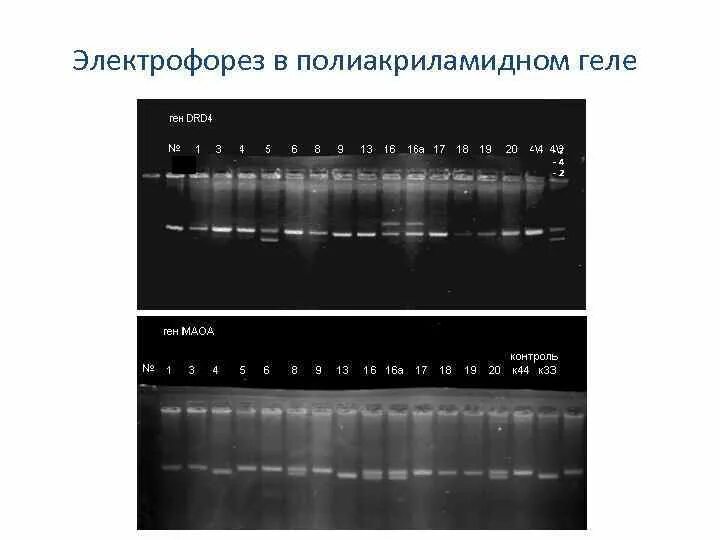 Фотограф электрофорез текст песни