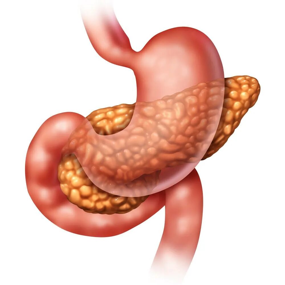 Панкреатит и язва желудка. Поджелудочная железа 3д анатомия. Калькулезный панкреатит. Хронический калькулезный панкреатит. Поджелудочная железа на белом фоне.