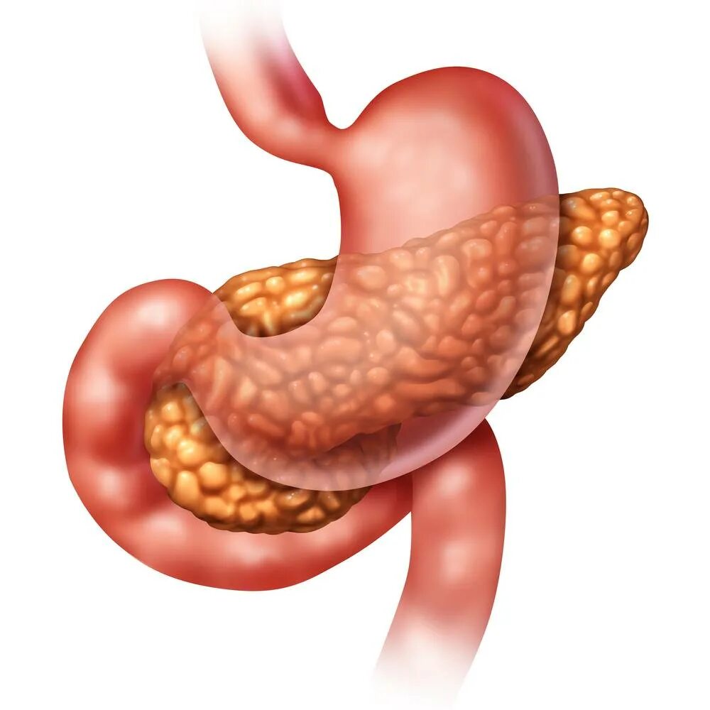 Панкреатит какой бок. Поджелудочная железа 3д анатомия. Калькулезный панкреатит. Хронический калькулезный панкреатит. Поджелудочная железа на белом фоне.