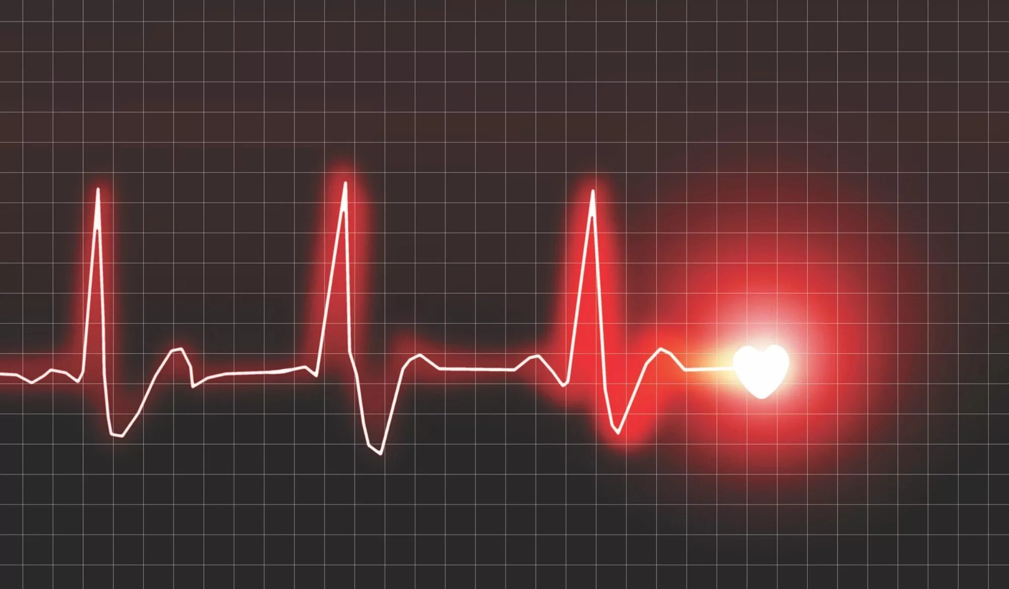 Сердцебиения 23. Диаграмма сердцебиения. Кардиограмма сердца. Биение сердца. Линия кардиограммы.