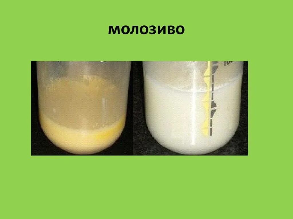 Как выглядит молозиво. Молозиво и молоко. Молозиво картинки. Как выглядит грудное молоко.