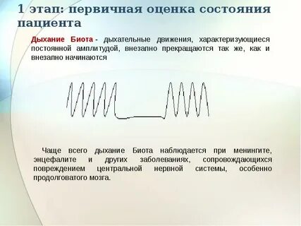 Внезапное дыхание