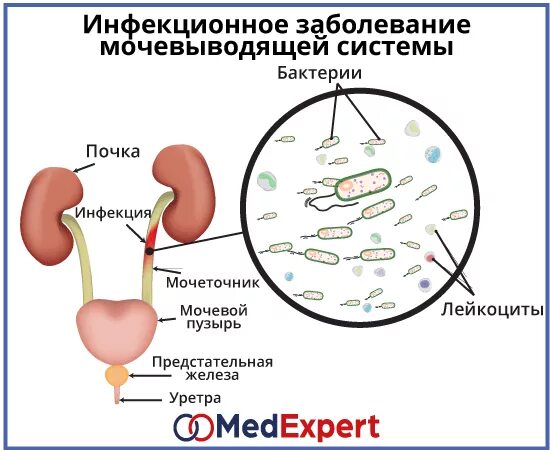 Как понять что проблемы с мочевым