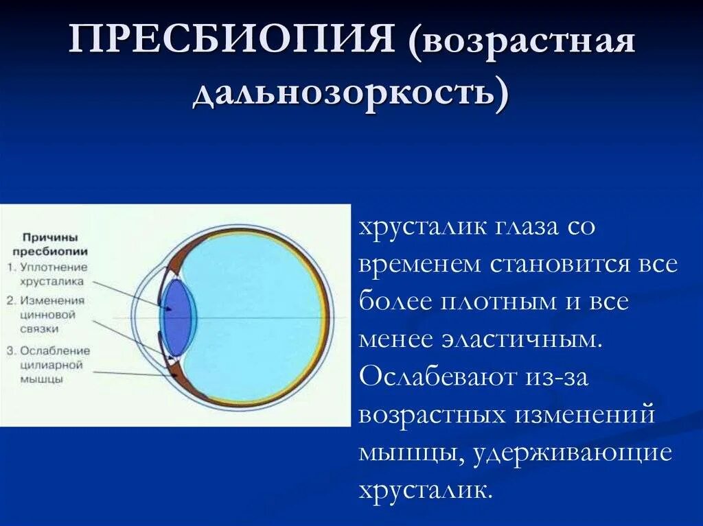 Пресбиопия. Пресбиопия (возрастная дальнозоркость). Гиперметропия возрастная. Дальнозоркость хрусталик. Причины аккомодации