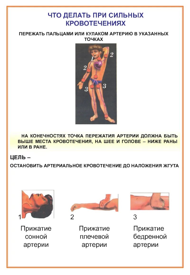 При сильном кровотечении нужно. Что делать при сильном кровотечении. Внутреннее кровотечение на руке. Пережатин бедренной артерии. Что делать при сильной кровопотере.