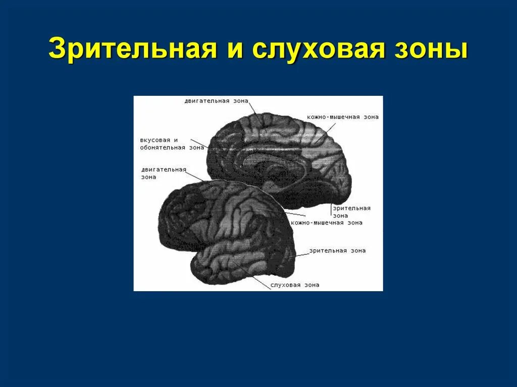 В какой доле слуховая зона. Слуховая зона. Слуховая зона расположена в. Зрительная и слуховая зоны. Где расположена слуховая зона коры.