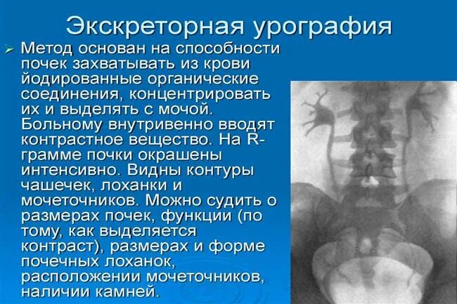 После урографии. После урографии