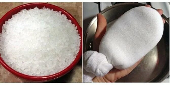 Как сделать сухой компресс. Сухой компресс. спиртовой компресс.
