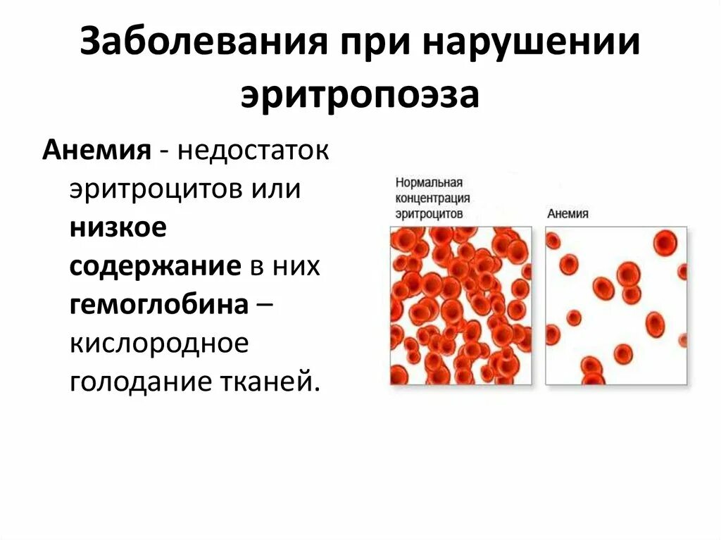 Малокровие эритроцитов. Заболевания эритроцитов. Заболевания при недостатке эритроцитов. Эритроциты при патологии. Нарушение системы эритроцитов..