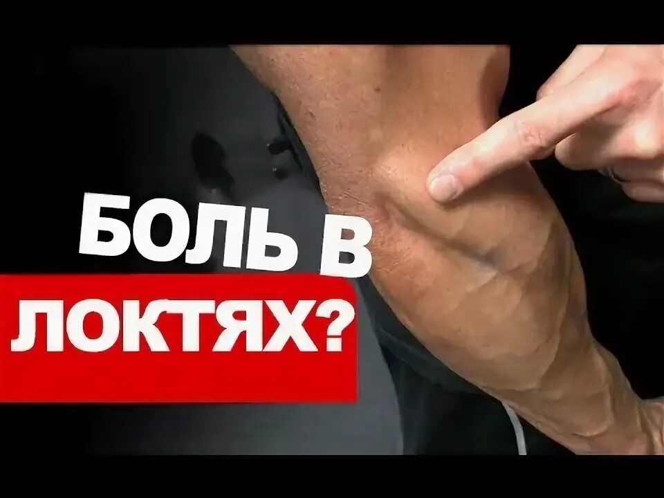 Перелом руки в армрестлинге. Связки армрестлера. Связка для армрестлинга. Травмы при армрестлинге. Хрустнул локоть в армрестлинге что это такое.