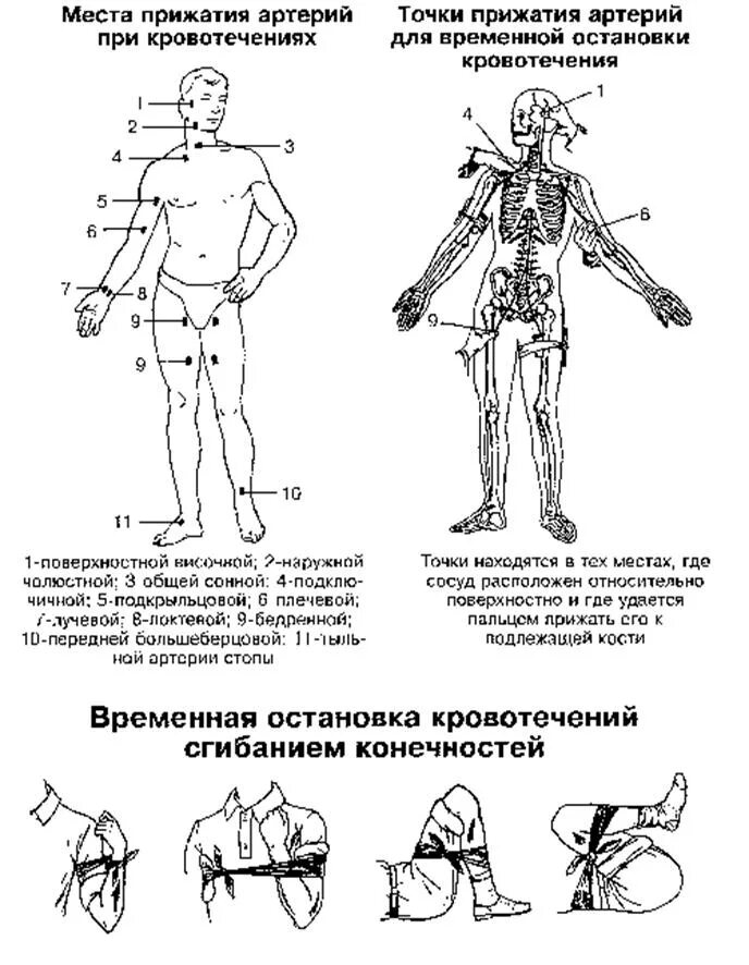 Первая помощь при кровотечениях схема. Пальцевое прижатие артерий таблица. Методы оказания первой помощи при кровотечении. Первое оказание помощи при кровотечении.