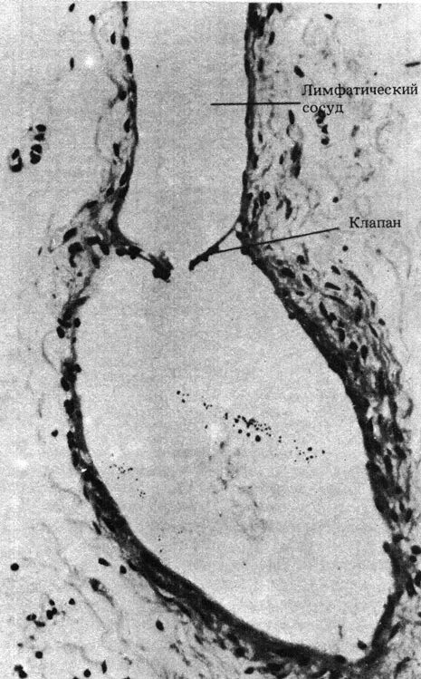 Лимфатические сосуды клапаны