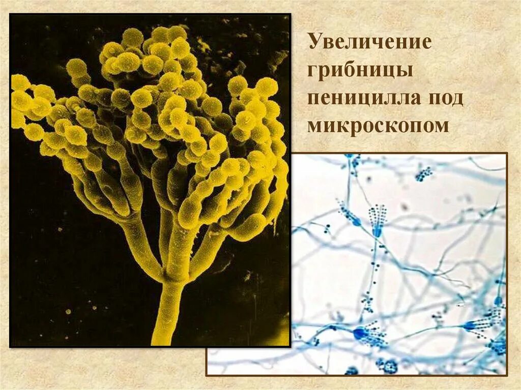 Пеницилл группа организмов. Гриб пеницилл плесень. Строение плесневого гриба пеницилла. Сизая плесень пеницилл. Строение плесени пеницилл.