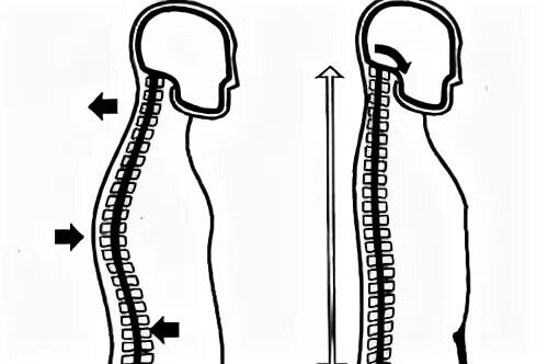 Прямо спинного. Правильная форма позвоночника. Прямой позвоночник. Прямой позвоночник без изгибов. Правильная форма позвоночника у женщин.