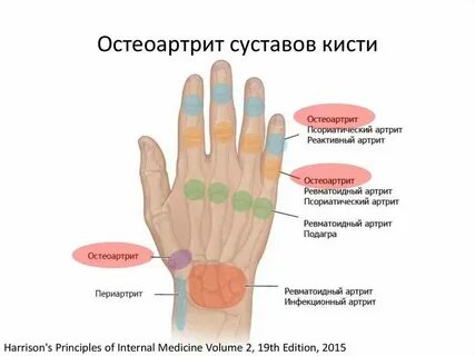 Болят пальцы на ногах и руках причины