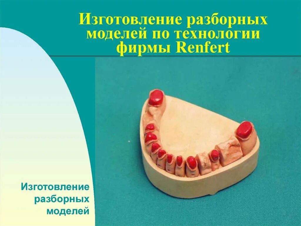 Изготовление разборной модели. Пиндекс система изготовления разборной модели. Разборная модель зуботехническая. Технология изготовления разборной модели.