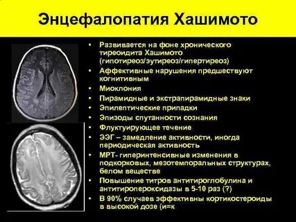 Энцефалопатия что делать