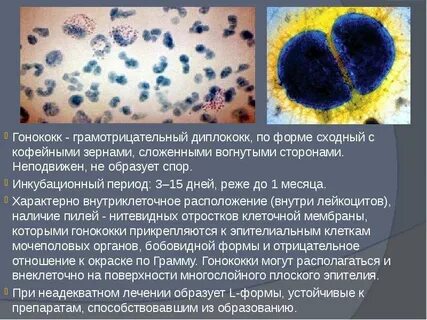 Диплококки