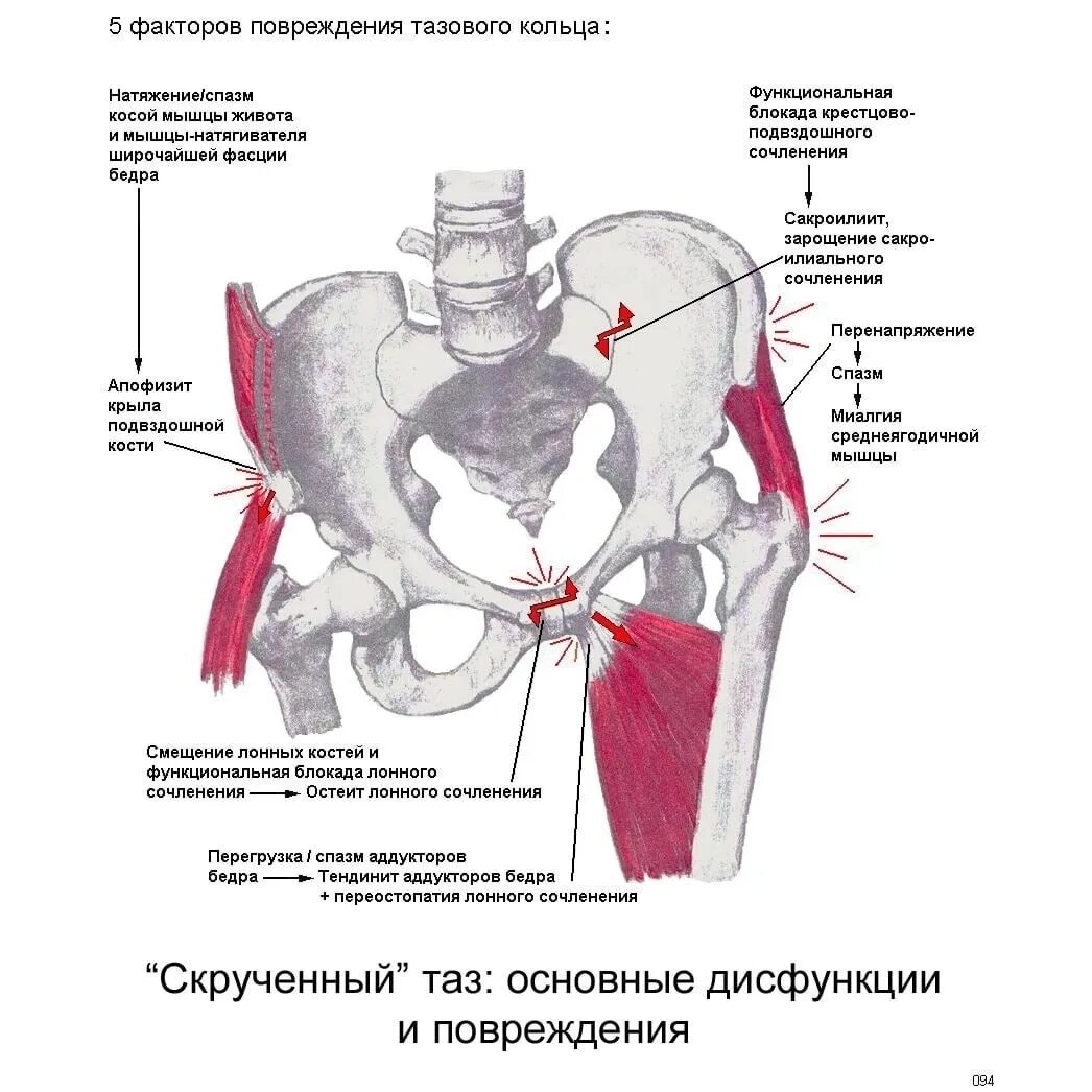 Тазобедренная боль у женщин причины и лечение. Симфизит тазобедренного сустава. Мышцы крестцово подвздошного сустава.