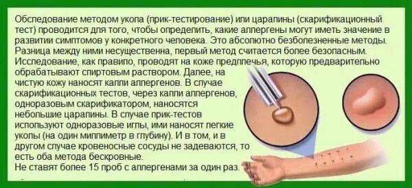 Аллергический ринит
