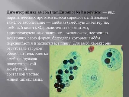 Какие простейшие вызывают