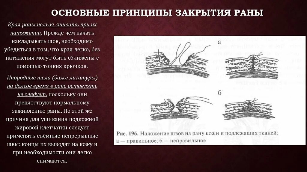 Нельзя проводить операцию. Основные принципы закрытия раны.