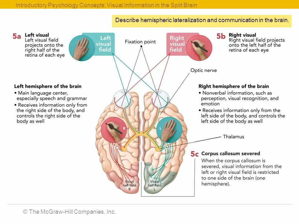 Split brain. Латерализация функций мозга. Латерализация это. Латерализация функций d/s.