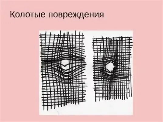 Колотое повреждение