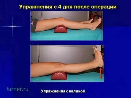 Лфк после операции эндопротезирования тазобедренного сустава