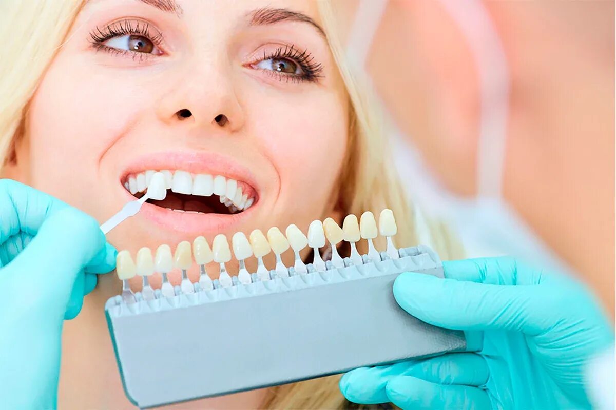 Отбеливание зубов. Красивые зубы. Красивые зубы стоматология.