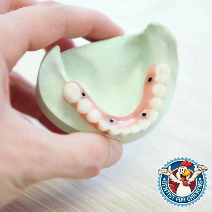 Протез нейлоновый односторонний (flexi n512). Частичный съёмный протез акрон. Частичный съёмный протез акрон. Протезы квадротти без неба. Частичный съёмный протез акрон.