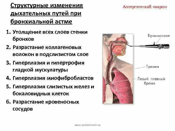 Бронхоскопия при бронхиальной астме. Морфологические изменения бронхов при бронхиальной астме. Фибробронхоскопия при бронхиальной астме. Фибробронхоскопия при бронхиальной астме заключение.