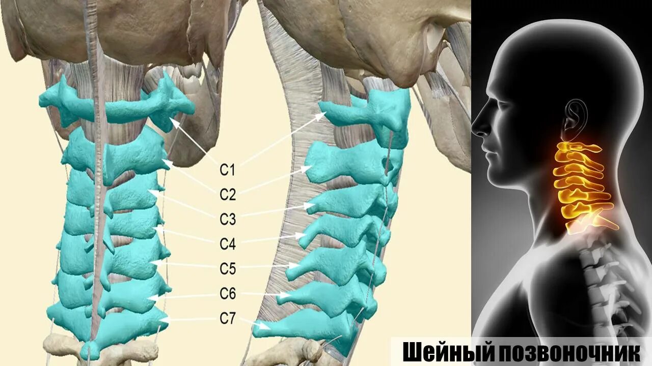 6 И 7 шейные позвонки. 7 Позвонок шейного отдела. Шейный отдел с4 с5. 3 И 4 шейные позвонки. Остеохондроз с7